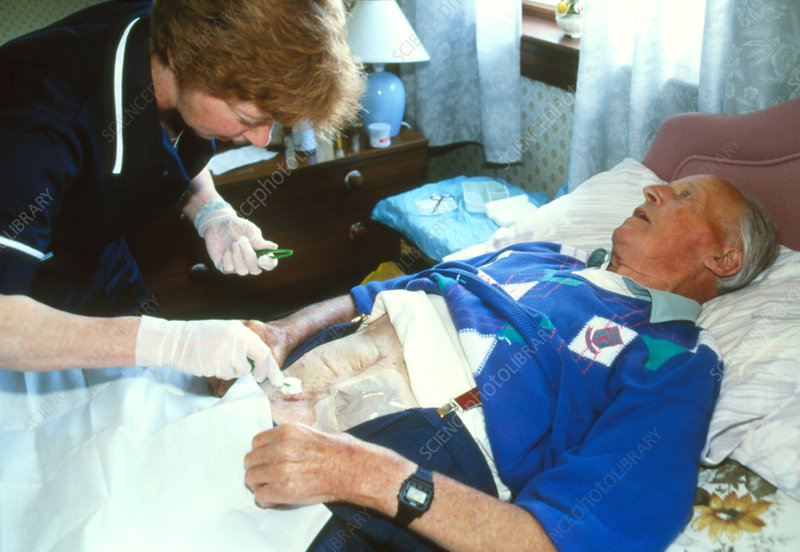 Colostomy Care Nurses